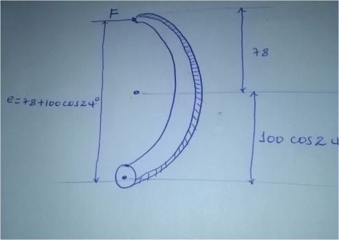 Figure shows how force is applied in right shoe of braking system.