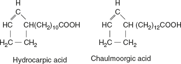 ch4-ufig1